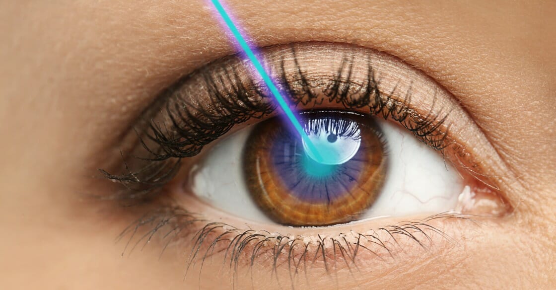 How long are your eyes good after LASIK?